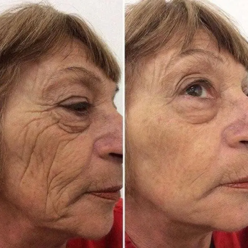 E S E N C I A Serum efecto botox ﻿